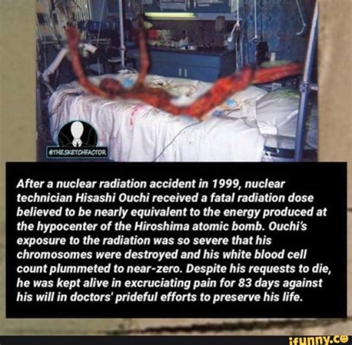Hisashi Ouchi Images After Radiation: A Deep Dive into the Tragic Incident and Its Aftermath