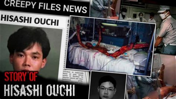 Hisashi Ouchi Photos: A Comprehensive Exploration of His Legacy and Contributions