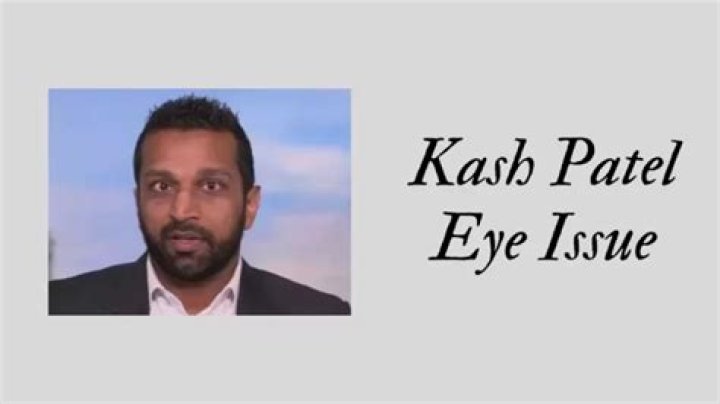 Kash Patel's Eyes Condition: A Comprehensive Guide