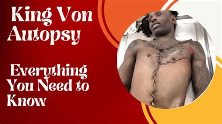 King Von Autopsy: An In-Depth Analysis of the Life and Legacy