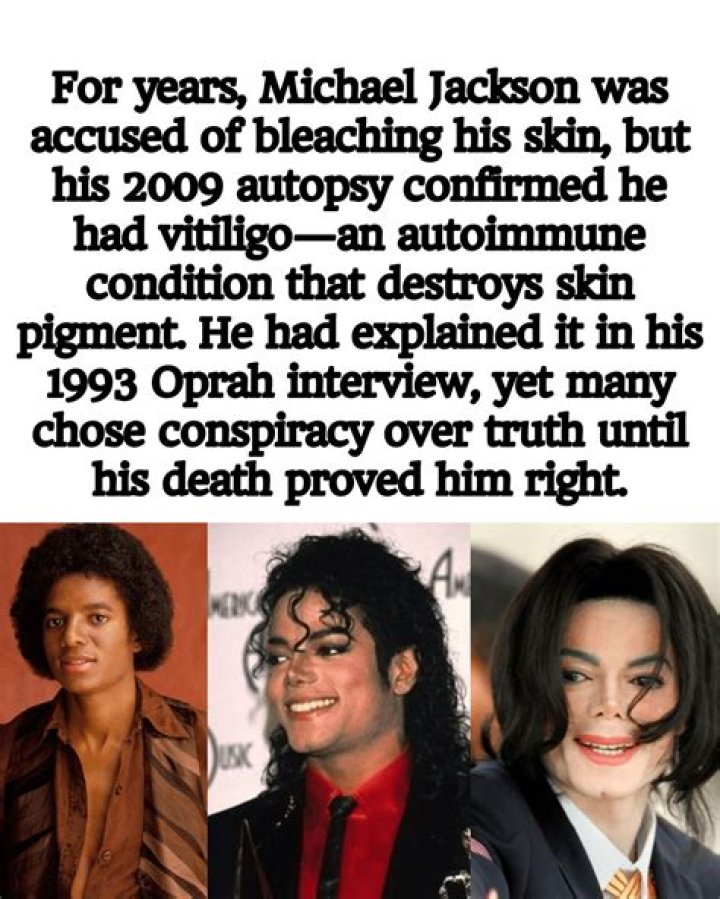 Michael Jackson Skin Bleaching: The Truth Behind the Controversy