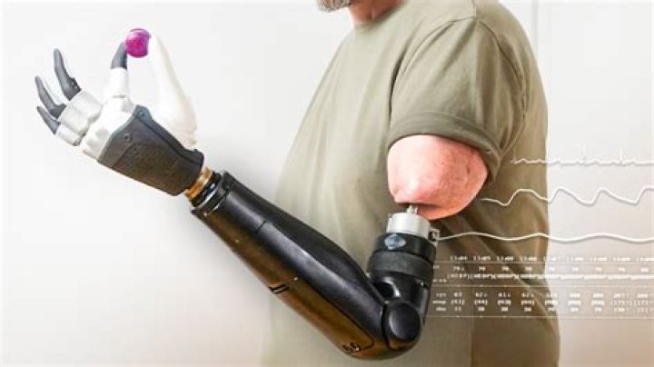 Point Design Prosthetics: Revolutionizing the Future of Mobility